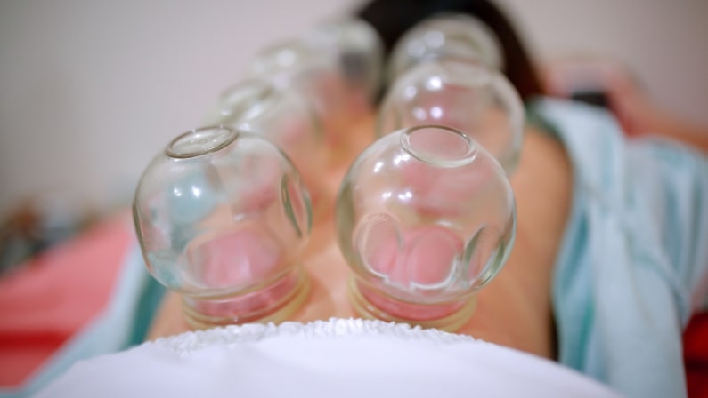 Benefits of Cupping Massage